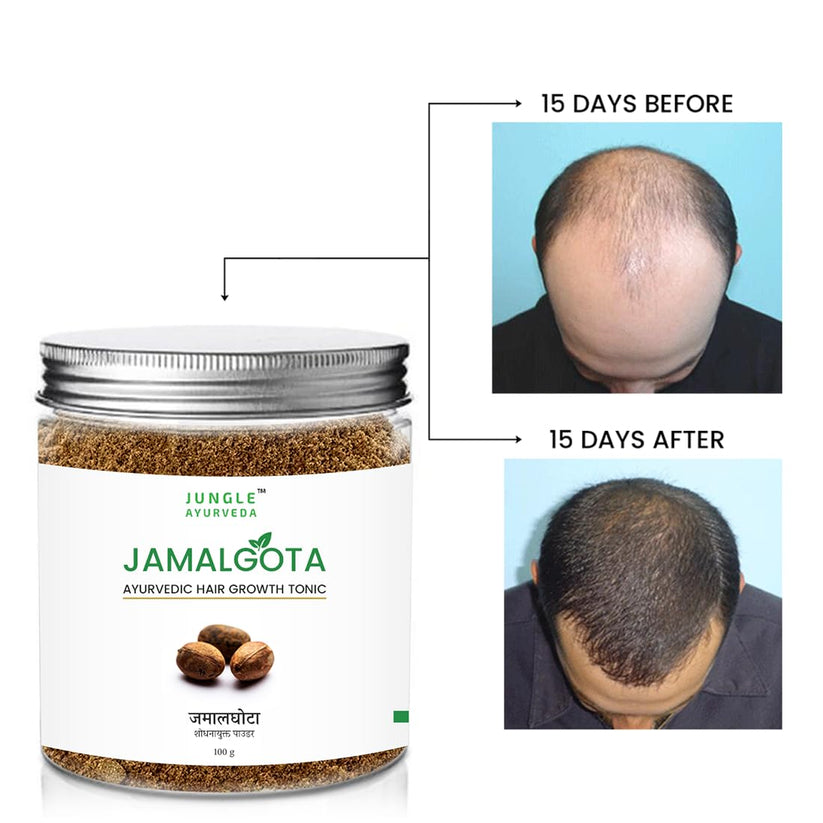 Jamalgota Ayurvedic Hair Growth Powder 100gm Each Pack of 2